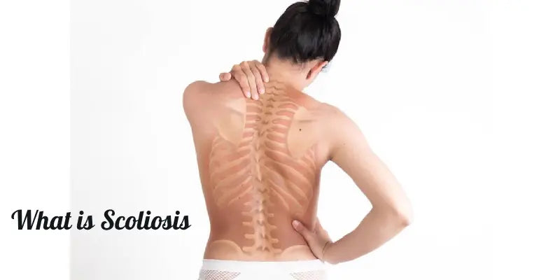 What is Scoliosis